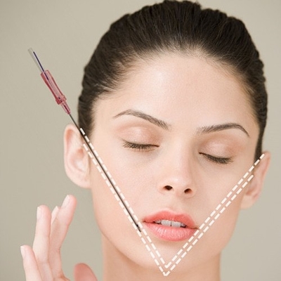 Hilo Nonsurgical 18G 100m m del diente de la elevación de cara del hilo de PDO para la elevación de cara inmediata